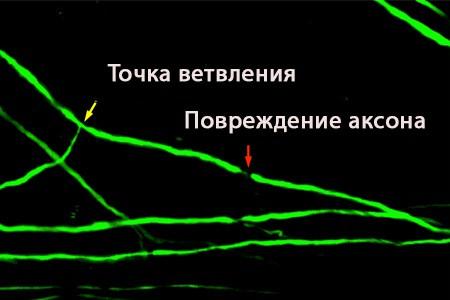 Нервные клетки спинного мозга восстанавливаются