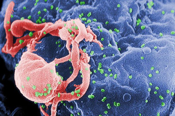 СПИД остается проблемой, несмотря на успехи науки
