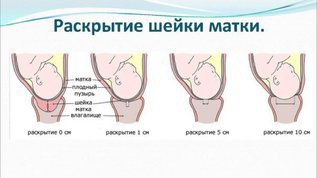 Роды - волнующий период в жизни женщины